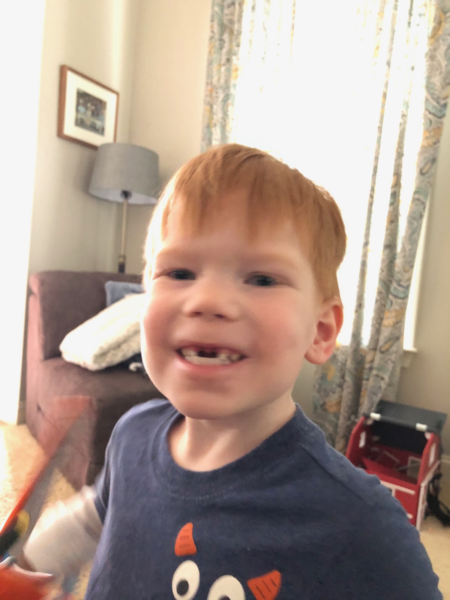 2018-03-01-brooks-teeth photo